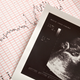 Image for article titled Anti-Abortion Groups Push 'Fetal Heartbeat' Bill In Every State
